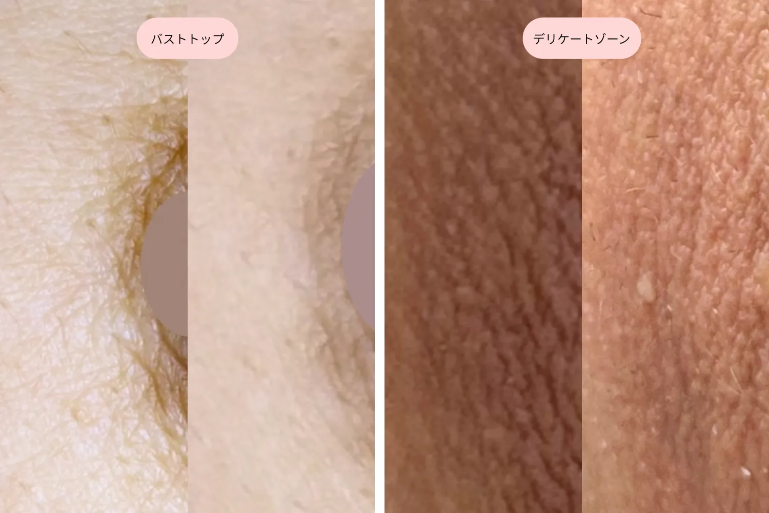 アマラピンク（BODY）